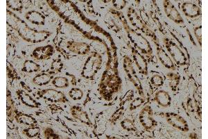 ABIN6276587 at 1/100 staining Human kidney tissue by IHC-P. (PML anticorps  (N-Term))