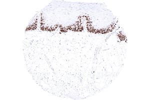 Esophageal squamous epithelium with moderate to strong nuclear MCM3 staining of suprabasal and basal cells (Recombinant MCM5 anticorps)