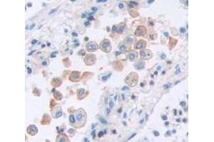 IHC-P analysis of Human Tissue, with DAB staining.