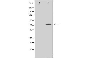 Western blot analysis of extracts from COLO cells using PPHLN antibody. (PPHLN1 anticorps  (N-Term))