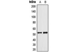 Western blot analysis of p53 (pS37) expression in COLO205 (A), Jurkat UV-treated (B) whole cell lysates. (p53 anticorps  (N-Term, pSer37))