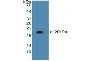 Western blot analysis of recombinant Human PPARd. (PPARD anticorps  (AA 260-426))
