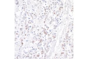 Immunohistochemistry (IHC) image for anti-WD Repeat Containing, Antisense To TP53 (WRAP53) (AA 1-50) antibody (ABIN7453892)