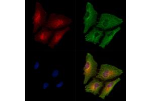 ABIN6258032 and ABIN6275061 staining  cells by IF/ICC. (DPYSL4 anticorps  (Internal Region))
