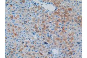 IHC-P analysis of Mouse Liver Tissue, with DAB staining. (MAPT anticorps  (AA 92-400))