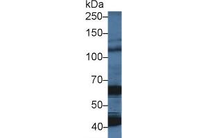 Western Blot; Sample: Porcine Cerebrum lysate; Primary Ab: 5µg/ml Rabbit Anti-Human OAS1 Antibody Second Ab: 0. (OAS1 anticorps  (AA 74-165))