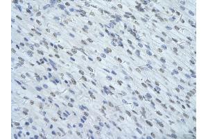 Rabbit Anti-HNRNPUL1 Antibody       Paraffin Embedded Tissue:  Human cardiac cell   Cellular Data:  Epithelial cells of renal tubule  Antibody Concentration:   4.