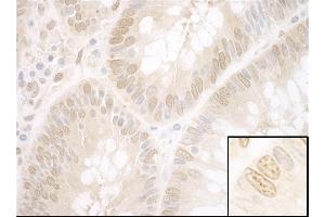anti-Nuclear Protein, Ataxia-Telangiectasia Locus (NPAT) (AA 700-750) antibody