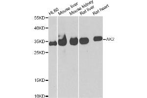 Western blot analysis of extracts of various cell lines, using AK2 antibody (ABIN5973904) at 1/1000 dilution. (Adenylate Kinase 2 anticorps)