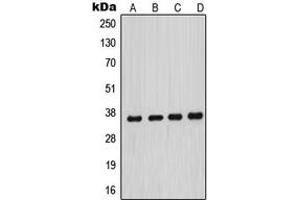 Western blot analysis of MNAT1 expression in HeLa (A), MCF7 (B), A431 (C), NIH3T3 (D) whole cell lysates. (MNAT1 anticorps  (Center))