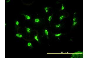 Immunofluorescence of monoclonal antibody to HDAC11 on HeLa cell. (HDAC11 anticorps  (AA 1-347))