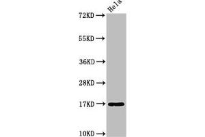 Western Blot Positive WB detected in: Hela whole cell lysate All lanes: C1D antibody at 3.