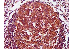 IHC image of ABIN7147144 diluted at 1:800 and staining in paraffin-embedded human lymph node tissue performed on a Leica BondTM system.