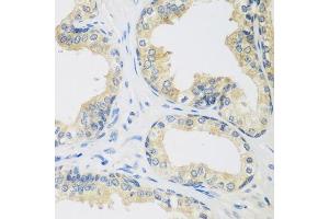 Immunohistochemistry of paraffin-embedded human prostate using UPF2 antibody.
