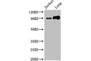 Western Blot Positive WB detected in: Jurkat whole cell lysate, Mouse lung tissue All lanes: STAT5B antibody at 2.