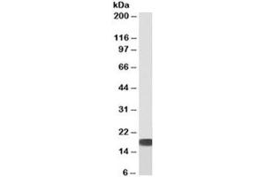 Western blot of human HEK293 cell lysate with biotinylated SOD antibody at 0. (SOD1 anticorps  (Biotin))