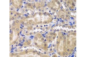 Immunohistochemistry of paraffin-embedded Mouse kidney using RPL5 Polyclonal Antibody at dilution of 1:200 (40x lens). (RPL5 anticorps)