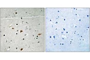 Immunohistochemistry analysis of paraffin-embedded human brain, using LIMK2 (Phospho-Ser283) Antibody.