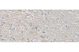 Immunohistochemistry of paraffin-embedded Human brain tissue using CDH12 Polyclonal Antibody at dilution of 1:60(x200)