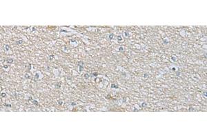 Immunohistochemistry of paraffin-embedded Human brain tissue using CDH12 Polyclonal Antibody at dilution of 1:60(x200) (Cadherin 12 anticorps)