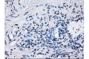 Immunohistochemical staining of paraffin-embedded Ovary tissue using anti-RNF144Bmouse monoclonal antibody. (RNF144B anticorps  (AA 1-256))