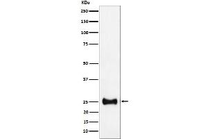 Western blot analysis of Adenylate kinase 4 expression in HepG2 cell lysate.