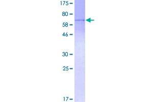 Image no. 1 for Excision Repair Cross-Complementing Rodent Repair Deficiency, Complementation Group 2 (ERCC2) (AA 1-405) protein (GST tag) (ABIN1353031)