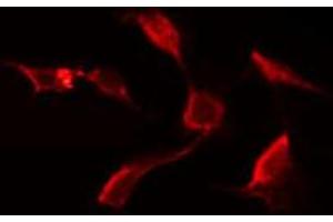 ABIN6272657 staining Hela by IF/ICC. (C-Type Lectin Domain Family 6, Member A (CLEC6A) (Internal Region) anticorps)
