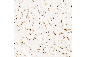 Immunohistochemistry of paraffin-embedded Mouse heart using SM/SNF5 antibody (ABIN7270657) at dilution of 1:1000 (40x lens). (SMARCB1 anticorps)