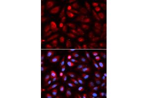 Immunofluorescence analysis of U2OS cell using ACP5 antibody. (ACP5 anticorps  (AA 76-325))