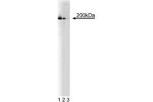 Western blot of analysis of KIF1A on a rat embryonic (E21) cerebrum lysate. (KIF1A anticorps  (AA 902-1015))