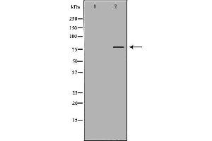 Western blot analysis of extracts of A549, using ABCG8antibody.
