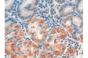 Detection of IFNa/bR1 in Human Stomach Tissue using Polyclonal Antibody to Interferon Alpha/Beta Receptor 1 (IFNa/bR1)