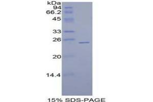 SDS-PAGE analysis of Human Sprouty Homolog 1 Protein. (SPRY1 Protéine)