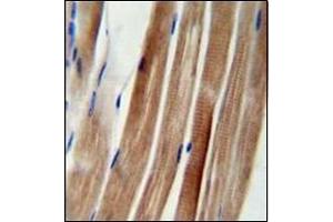 Immunohistochemistry analysis in formalin fixed and paraffin embedded human skeletal muscle reacted with KIAA1310 Antibody (Center) followed which was peroxidase conjugated to the secondary antibody and followed by DAB staining. (KANSL3 anticorps  (Middle Region))