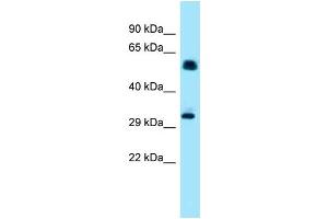Western Blotting (WB) image for anti-Inositol Hexakisphosphate Kinase 1 (IP6K1) (N-Term) antibody (ABIN2789109) (IP6K1 anticorps  (N-Term))