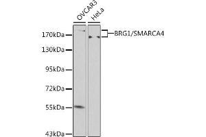 Western blot analysis of extracts of various cell lines, using BRG1/BRG1/SM antibody (ABIN6133730, ABIN6148100, ABIN6148101 and ABIN7101348) at 1:500 dilution. (SMARCA4 anticorps  (AA 30-130))