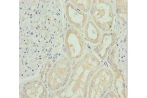 Immunohistochemistry of paraffin-embedded human kidney tissue using ABIN7171148 at dilution of 1:100 (SNAP29 anticorps  (AA 1-258))