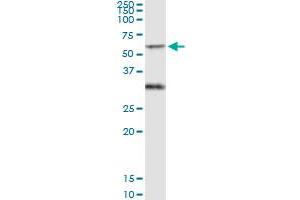 Immunoprecipitation of PICK1 transfected lysate using anti-PICK1 MaxPab rabbit polyclonal antibody and Protein A Magnetic Bead , and immunoblotted with PICK1 purified MaxPab mouse polyclonal antibody (B01P) .