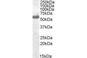 ABIN2563472 (0. (IRF5 anticorps  (C-Term))