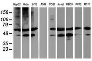 Image no. 2 for anti-Tubulin, alpha-Like 3 (TUBAL3) (AA 150-446) antibody (ABIN1490960) (TUBAL3 anticorps  (AA 150-446))