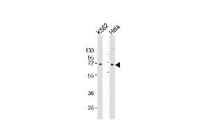 All lanes : Anti-ZN Antibody (C-term) at 1:2000 dilution Lane 1: K562 whole cell lysates Lane 2: Hela whole cell lysates Lysates/proteins at 20 μg per lane. (ZNF257 anticorps  (C-Term))