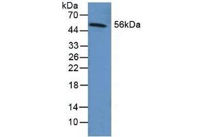 Detection of FGB in Human Liver Tissue using Polyclonal Antibody to Fibrinogen Beta Chain (FGB)