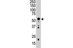 Western blot analysis of PDK2 polyclonal antibody  in mouse intestine tissue lysate (35 ug/lane).