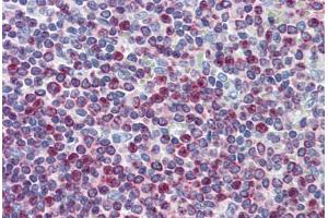 Human Spleen: Formalin-Fixed, Paraffin-Embedded (FFPE)