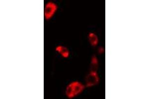 ABIN6274830 staining HuvEc cells by IF/ICC. (AKR1B1 anticorps  (C-Term))