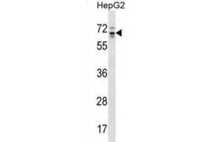 Western Blotting (WB) image for anti-rho GTPase Activating Protein 36 (ARHGAP36) antibody (ABIN2998590)