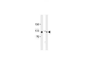 TGM2 Antibody (Center ) (ABIN392285 and ABIN2841950) western blot analysis in HUVEC,K562 cell line lysates (35 μg/lane). (Transglutaminase 2 anticorps  (AA 429-458))