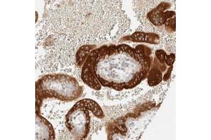 Immunohistochemical staining of human placenta with LETM2 polyclonal antibody  shows strong cytoplasmic positivity in trophoblastic cells at 1:200-1:500 dilution. (LETM2 anticorps)