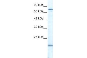 WB Suggested Anti-PGBD3 Antibody Titration:  2. (PGBD3 anticorps  (N-Term))